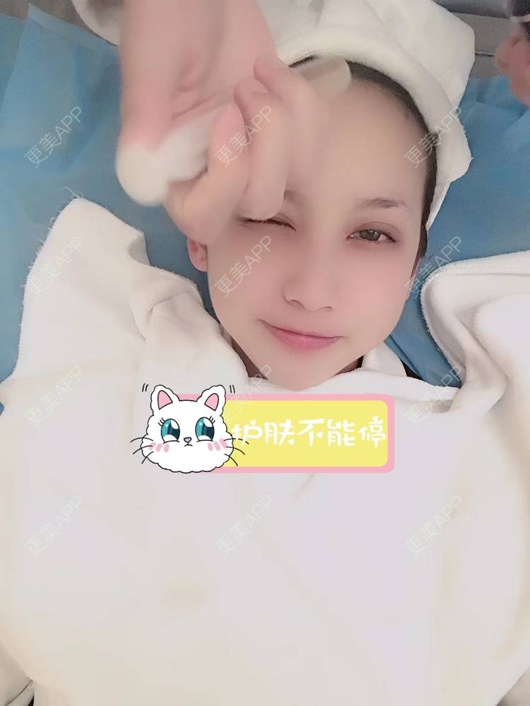 更美 - 疯疯癫癫小青年娅娅的吸脂瘦脸经验 | 双下巴吸脂 | 吸脂瘦脸 | 昆明