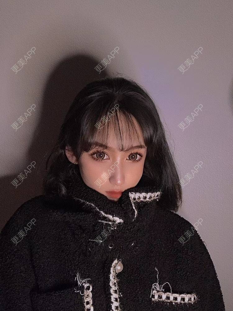 更美 - 疯疯癫癫小青年娅娅的吸脂瘦脸经验 | 双下巴吸脂 | 吸脂瘦脸 | 昆明