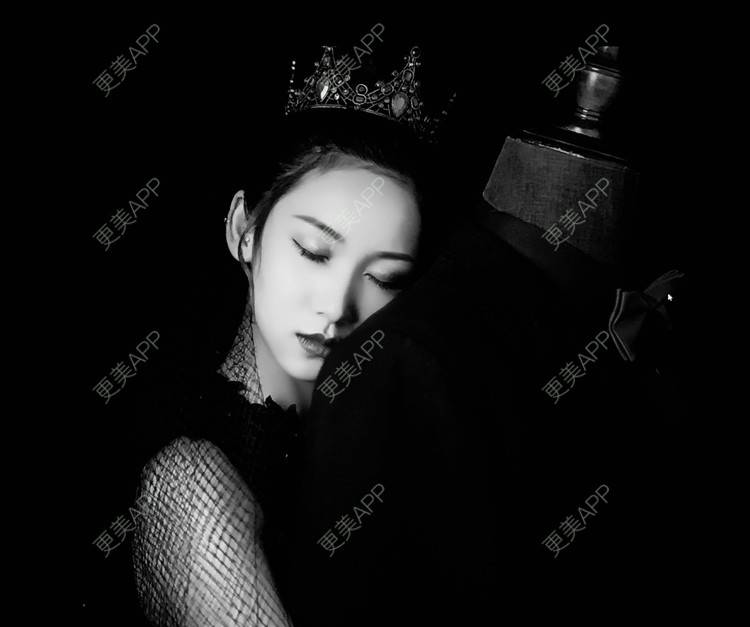 更美 - 疯疯癫癫小青年娅娅的吸脂瘦脸经验 | 双下巴吸脂 | 吸脂瘦脸 | 昆明