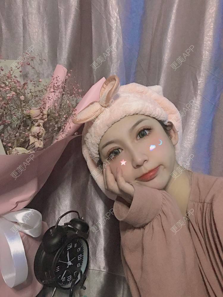 更美 - 疯疯癫癫小青年娅娅的吸脂瘦脸经验 | 双下巴吸脂 | 吸脂瘦脸 | 昆明