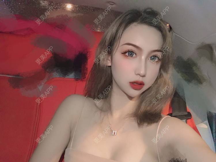 更美 - 疯疯癫癫小青年娅娅的吸脂瘦脸经验 | 双下巴吸脂 | 吸脂瘦脸 | 昆明