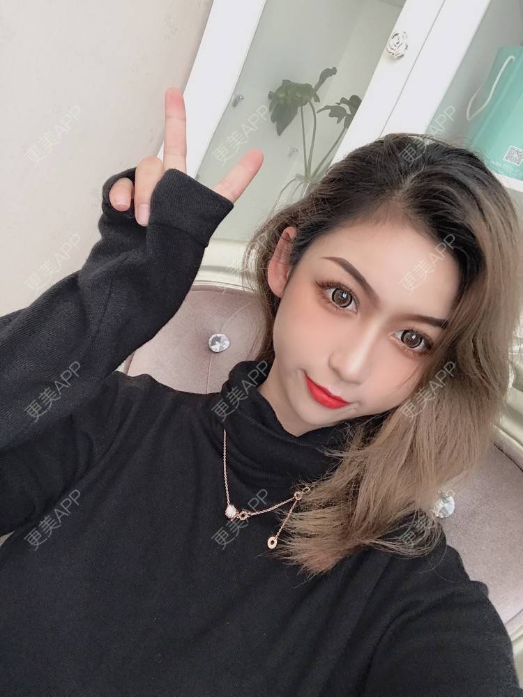 更美 - 疯疯癫癫小青年娅娅的吸脂瘦脸经验 | 双下巴吸脂 | 吸脂瘦脸 | 昆明