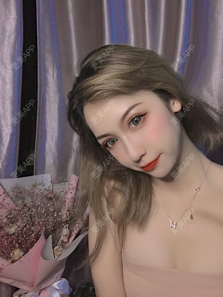 更美 - 疯疯癫癫小青年娅娅的吸脂瘦脸经验 | 双下巴吸脂 | 吸脂瘦脸 | 昆明