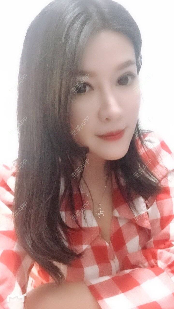 更美 - 甘思佳的热玛吉经验 | 北京 | 热玛吉