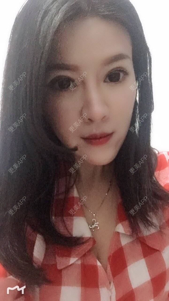 更美 - 甘思佳的热玛吉经验 | 北京 | 热玛吉