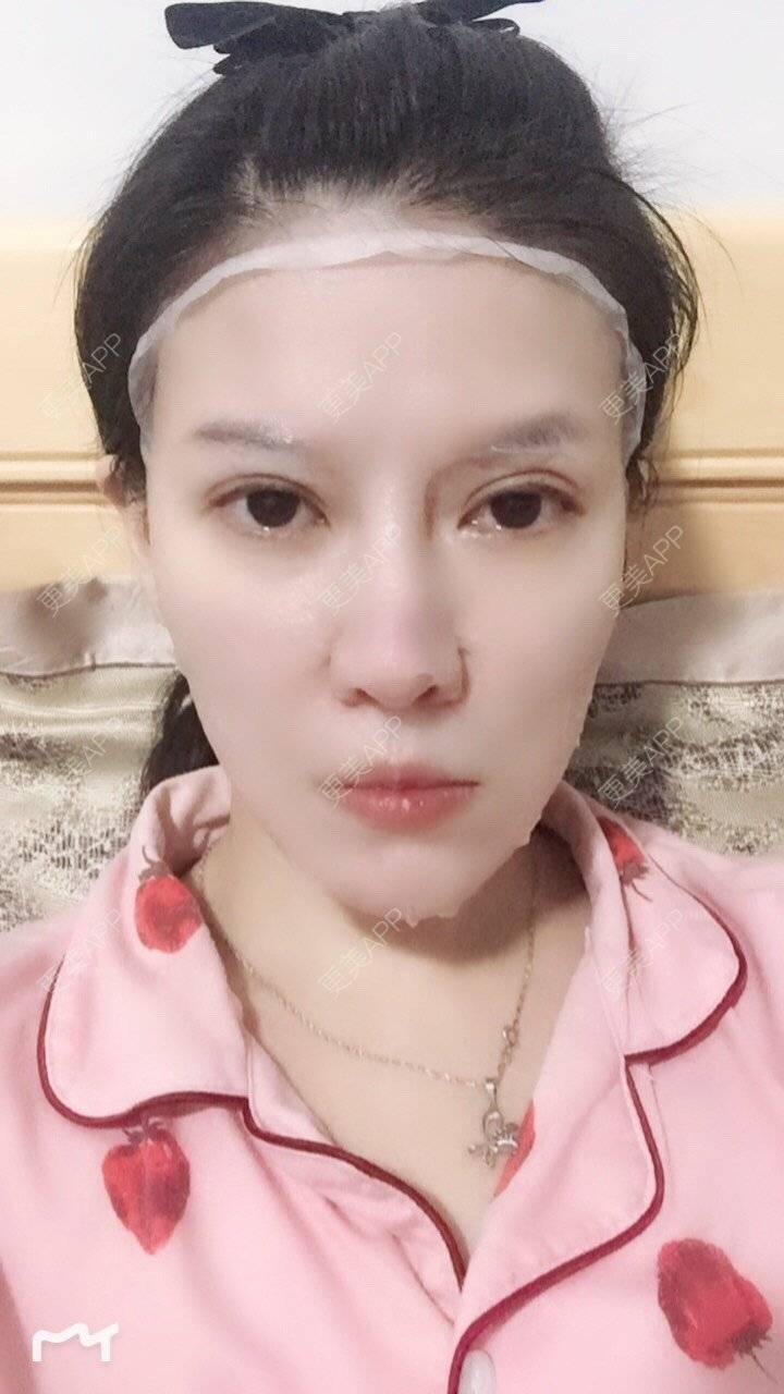 更美 - 甘思佳的热玛吉经验 | 北京 | 热玛吉
