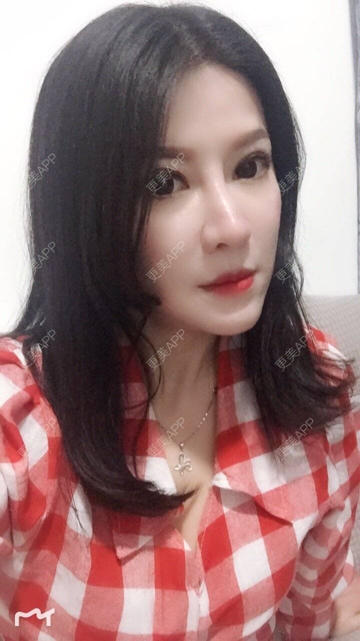 更美 - 甘思佳的热玛吉经验 | 北京 | 热玛吉
