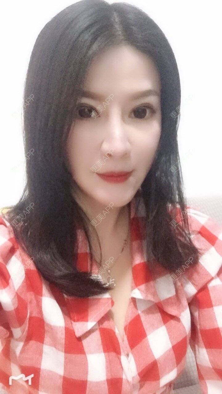 更美 - 甘思佳的热玛吉经验 | 北京 | 热玛吉