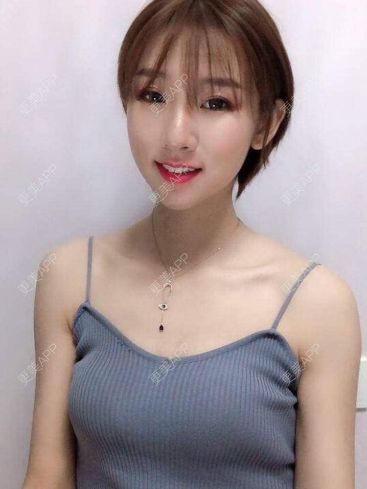 更美 - 碳水的除皱瘦脸经验 | 除皱瘦脸 | 杭州