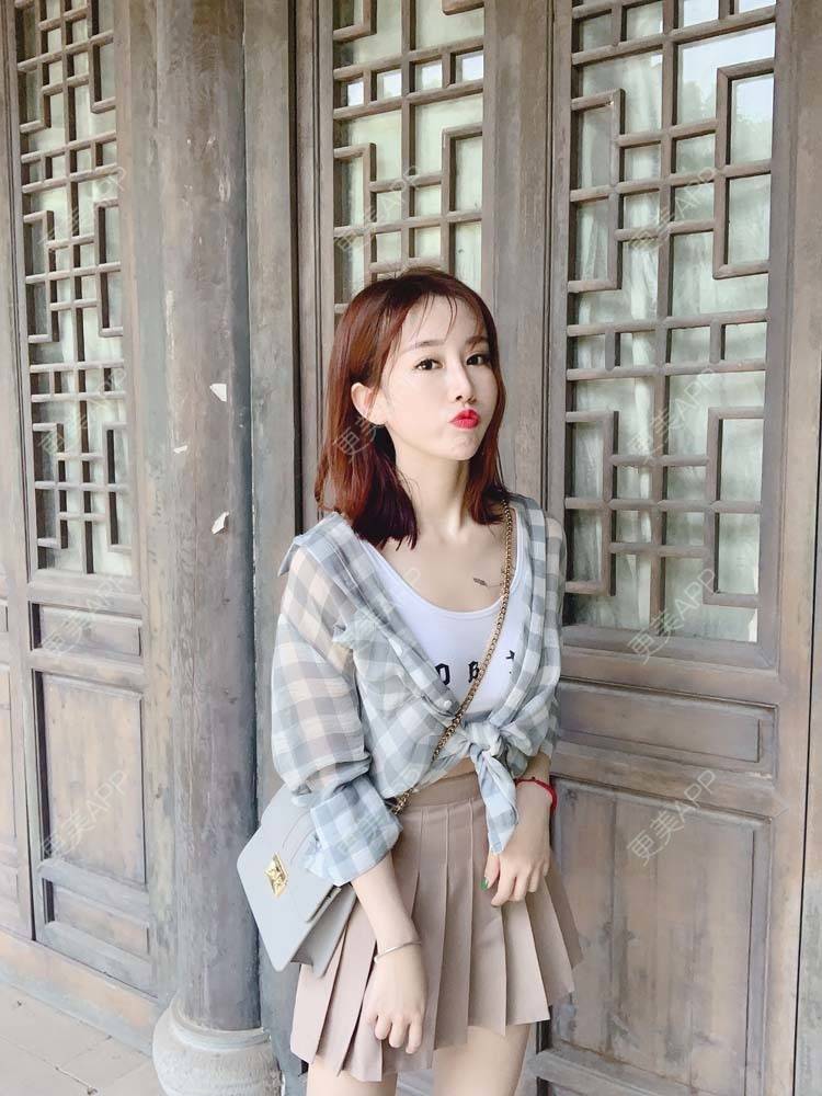 更美 - 更美用户PbmPgI4oPN的玻尿酸鼻部经验 | 玻尿酸鼻部 | 玻尿酸额头 | 玻尿酸太阳穴 | 玻尿酸法令纹 | 玻尿酸面部细纹