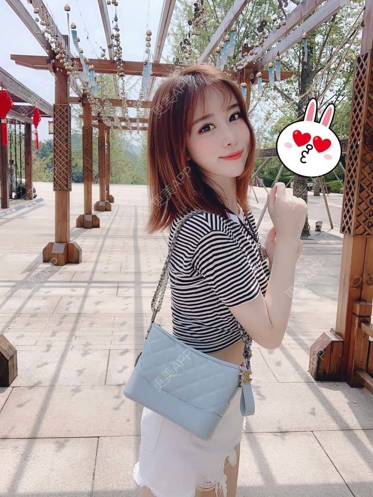更美 - 更美用户PbmPgI4oPN的玻尿酸鼻部经验 | 玻尿酸鼻部 | 玻尿酸额头 | 玻尿酸太阳穴 | 玻尿酸法令纹 | 玻尿酸面部细纹