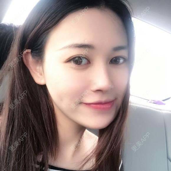 更美 - 氵氵氵氵氵氵氵氵氵的自体脂肪全面部填充经验 | 自体脂肪全面部填充 | 杭州