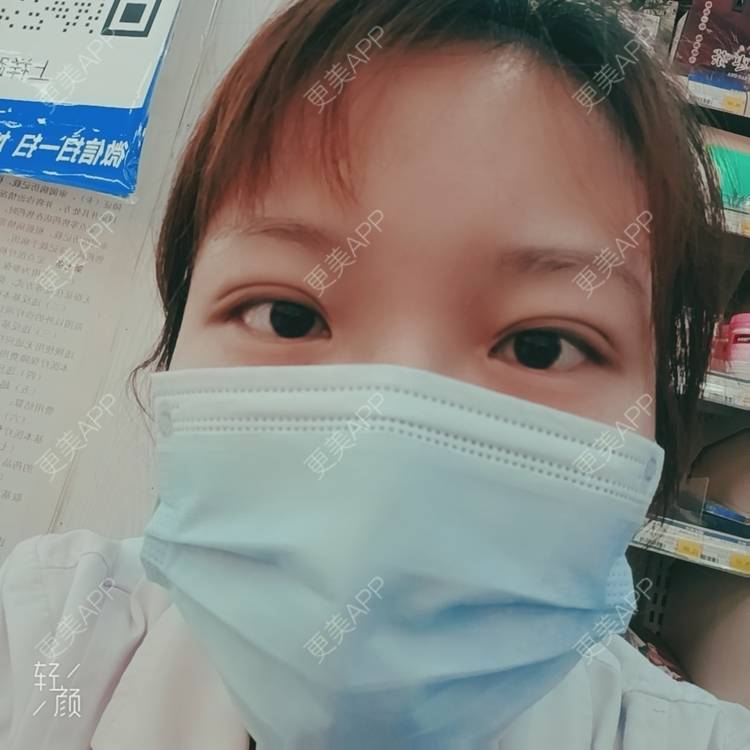 更美 - 更美用户tbs28rKiLZ的定点双眼皮经验 | 定点双眼皮 | 杭州