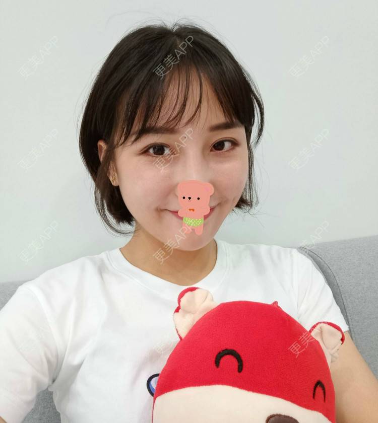 更美 - 更美用户1ieoNiY7aB的植发际线经验 | 北京 | 植发际线 | 毛发移植