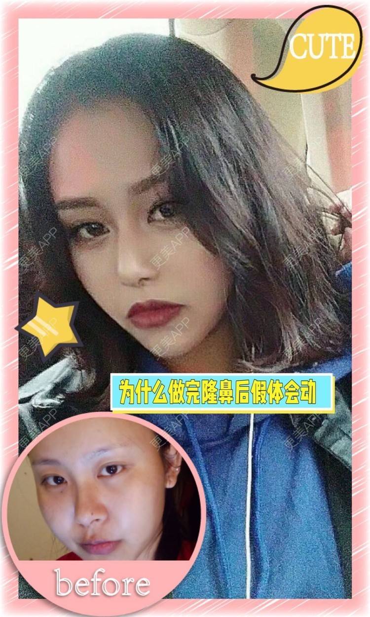 更美 - 顾陆健 医生的鼻部多项经验 | 鼻部多项 | 苏州