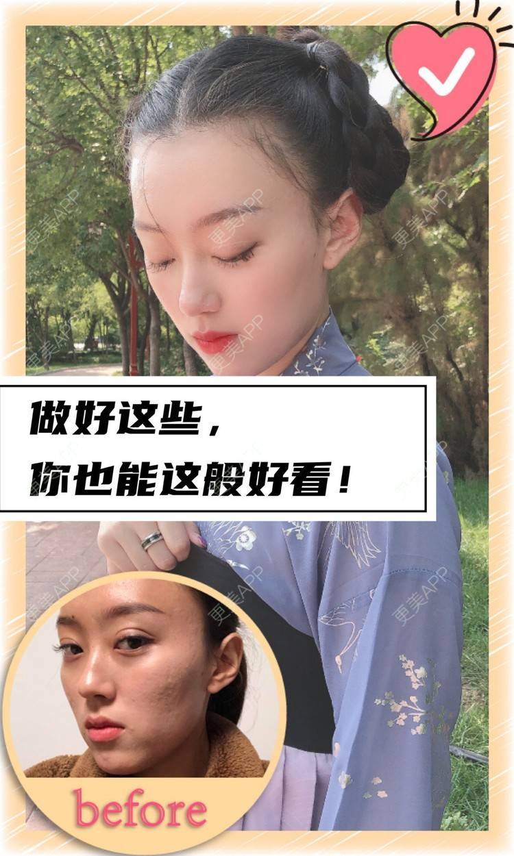 更美 - 顾陆健 医生的鼻部多项经验 | 鼻部多项 | 苏州