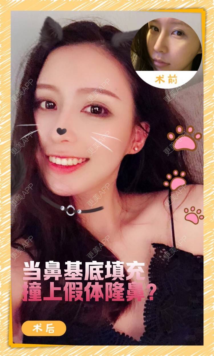 更美 - 顾陆健 医生的鼻部多项经验 | 鼻部多项 | 苏州