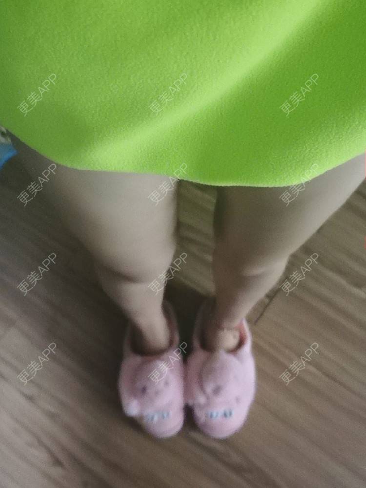 更美 - 沉沉mm的吸脂瘦脸经验 | 全脸整形套餐 | V脸套餐 | 射频溶脂瘦脸 | 激光溶脂瘦脸 | 注射溶脂瘦脸 | 吸脂瘦脸 | 自体脂肪丰面颊 | 吸脂 | 腰腹吸脂 | 背部吸脂 | 手臂吸脂 | 玻尿酸面颊 | 胶原蛋白丰面颊 | 面部不对称矫正