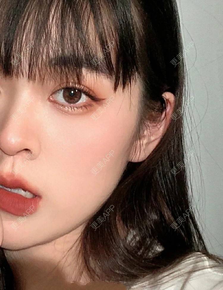 更美用户csua6yajl7的全切双眼皮日记