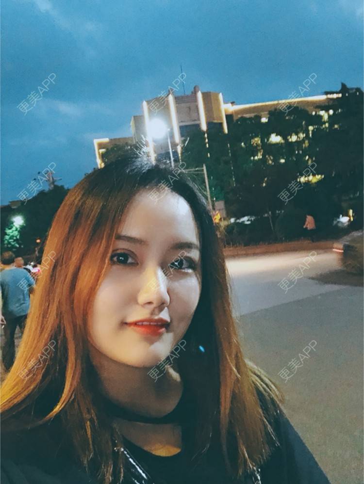 更美 - 奥多Ke。的植发际线经验 | 植发际线 | 南昌