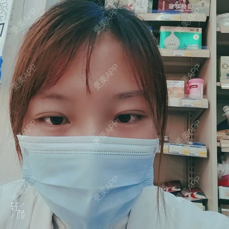 更美 - 更美用户tbs28rKiLZ的定点双眼皮经验 | 定点双眼皮 | 杭州