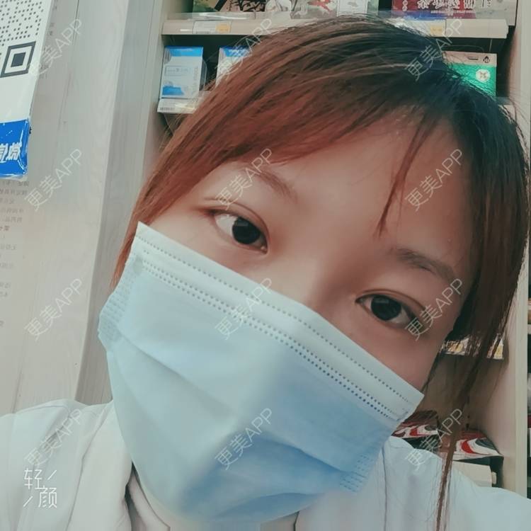 更美 - 更美用户tbs28rKiLZ的定点双眼皮经验 | 定点双眼皮 | 杭州