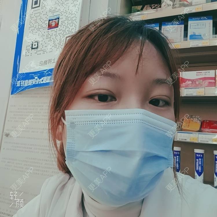 更美 - 更美用户tbs28rKiLZ的定点双眼皮经验 | 定点双眼皮 | 杭州