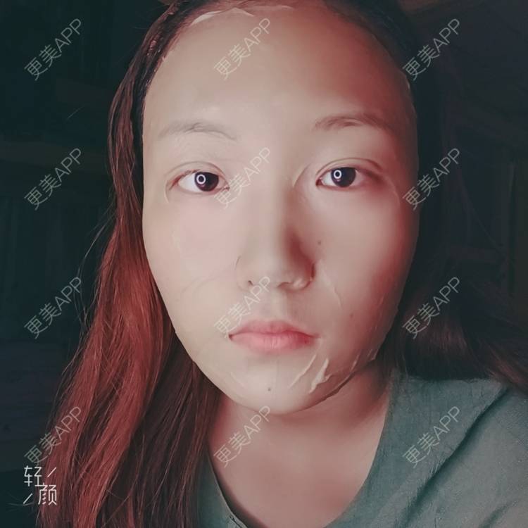 更美 - 更美用户tbs28rKiLZ的定点双眼皮经验 | 定点双眼皮 | 杭州