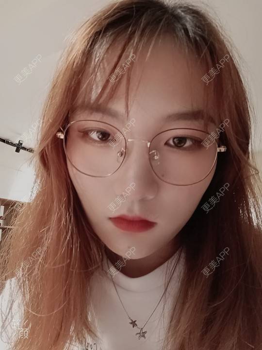 更美 - 更美用户tbs28rKiLZ的定点双眼皮经验 | 定点双眼皮 | 杭州