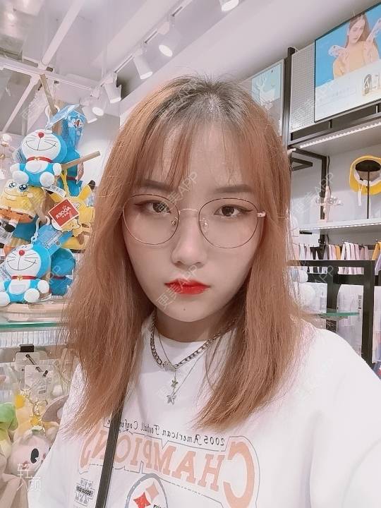 更美 - 更美用户tbs28rKiLZ的定点双眼皮经验 | 定点双眼皮 | 杭州