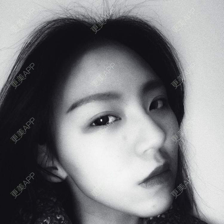 更美 - 吃飯從來用湯勺√的自体脂肪隆鼻经验 | 成都 | 自体脂肪隆鼻 | 视频日记