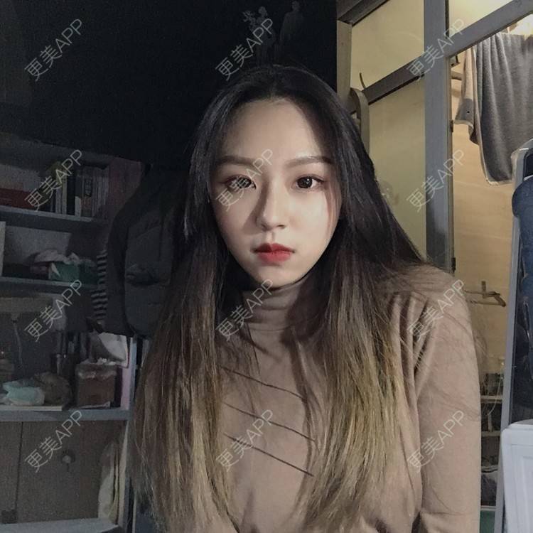 更美 - 吃飯從來用湯勺√的自体脂肪隆鼻经验 | 成都 | 自体脂肪隆鼻 | 视频日记