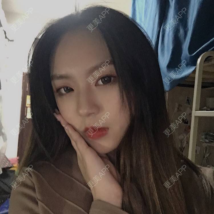 更美 - 吃飯從來用湯勺√的自体脂肪隆鼻经验 | 成都 | 自体脂肪隆鼻 | 视频日记