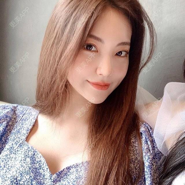 更美 - 兰花执着频的额头缩小经验 | 额头缩小
