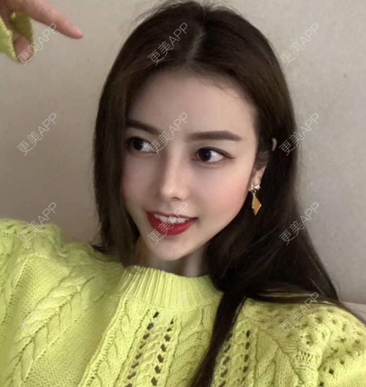 triangled的肋软骨隆鼻日记