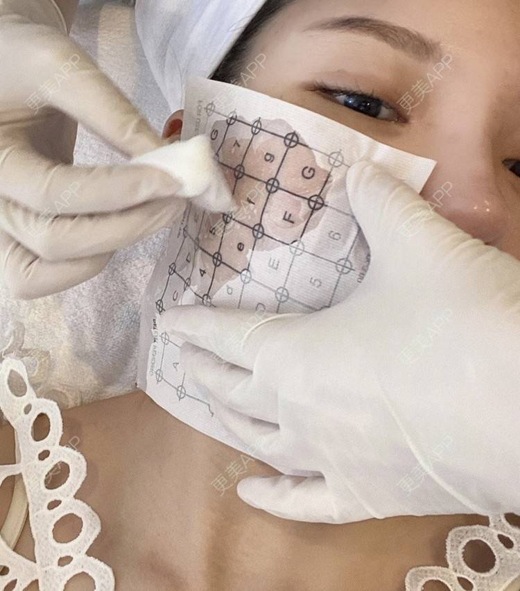更美 - 真人小助手的热玛吉经验 | 重庆 | 热玛吉