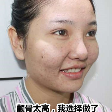 陈玉琼 医生