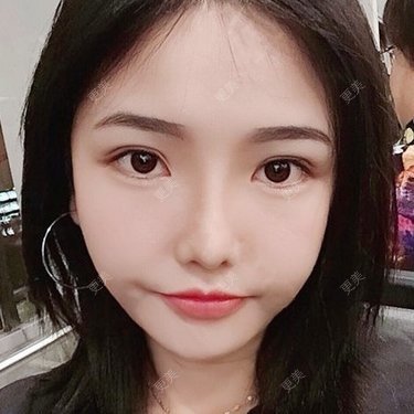 陈玉琼 医生