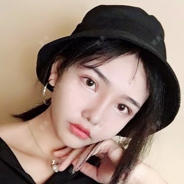 陈玉琼 医生