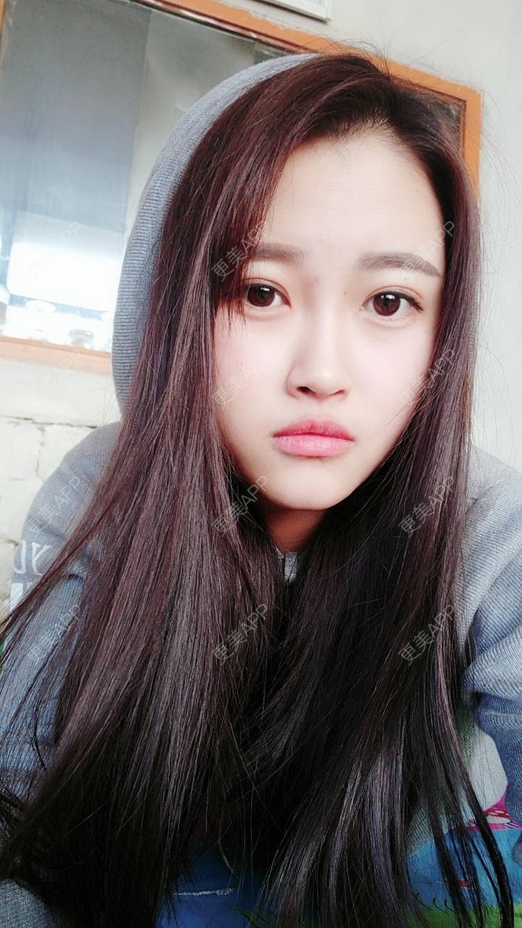 更美 - 更美用户e0hWeDB8oW的经验 | 郑州 | 视频日记 | 颧骨提高