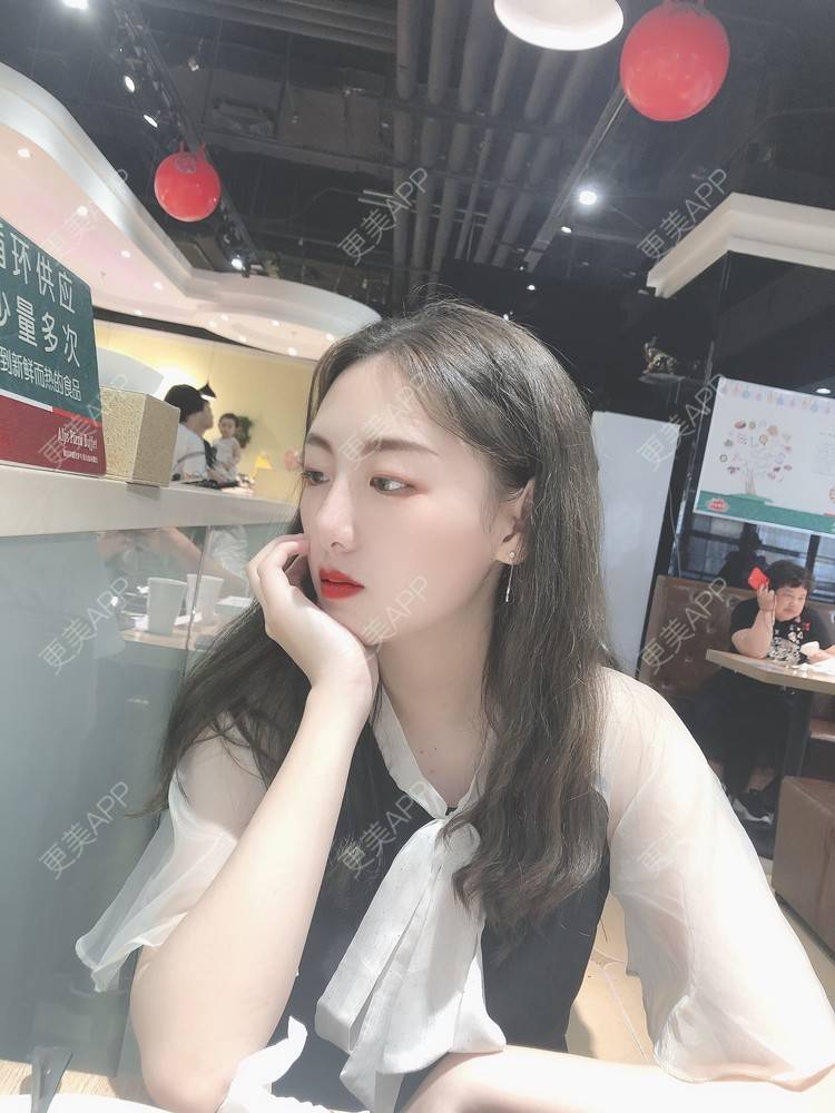 更美 - 七寻笑伪的淡斑套餐经验 | 淡斑套餐 | 北京