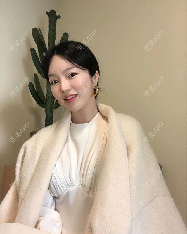 更美 - 更美用户pGJFYtQhaA的膨体垫眉弓经验 | 膨体垫眉弓 | 上海