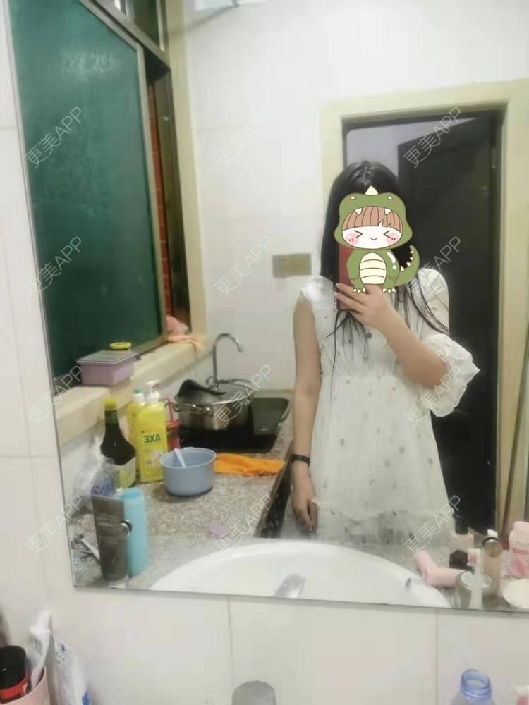 更美 - 更美用户jHjijlJNxV的手臂吸脂经验 | 手臂吸脂 | 广州