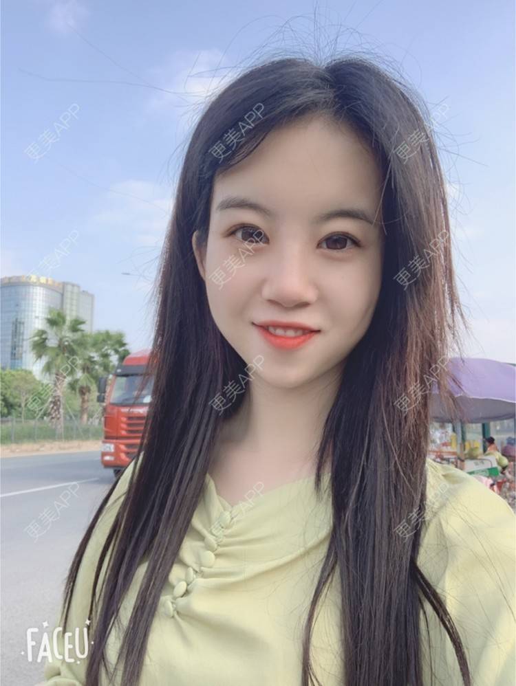 更美 - 甜宠女主的除皱瘦脸经验 | 除皱瘦脸 | 深圳