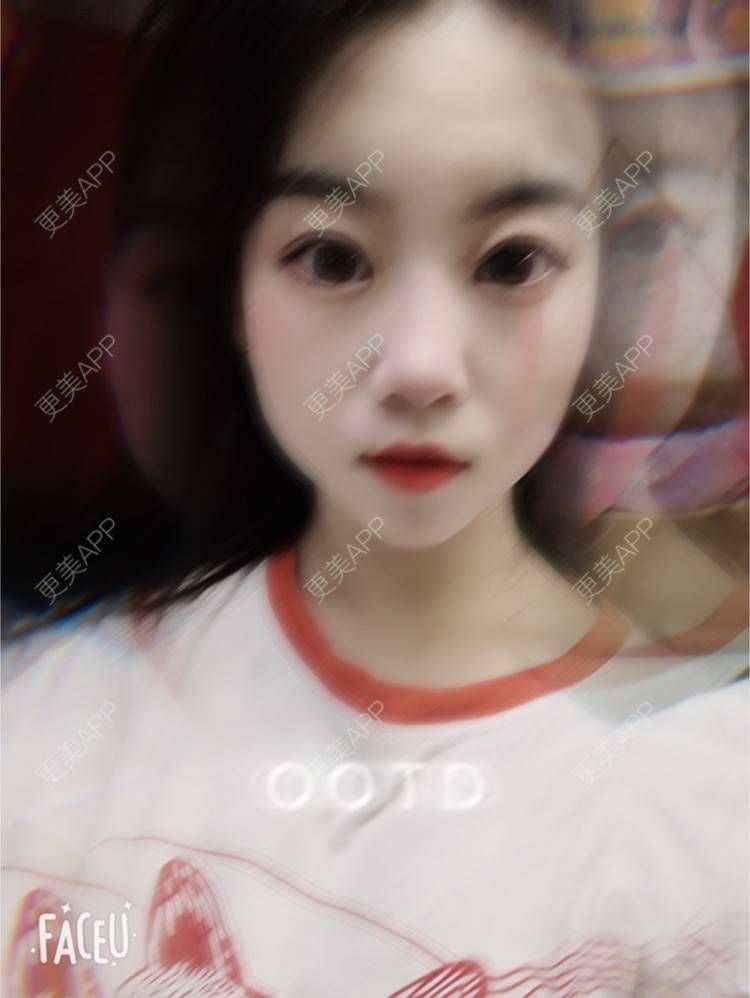 更美 - 甜宠女主的除皱瘦脸经验 | 除皱瘦脸 | 深圳