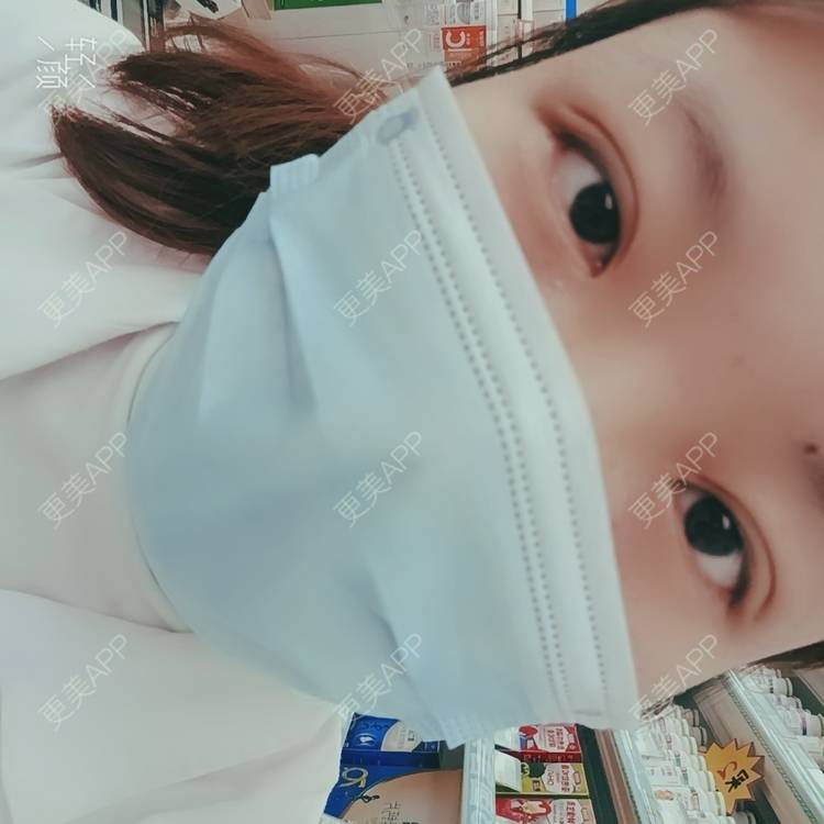 更美 - 更美用户tbs28rKiLZ的定点双眼皮经验 | 定点双眼皮 | 杭州
