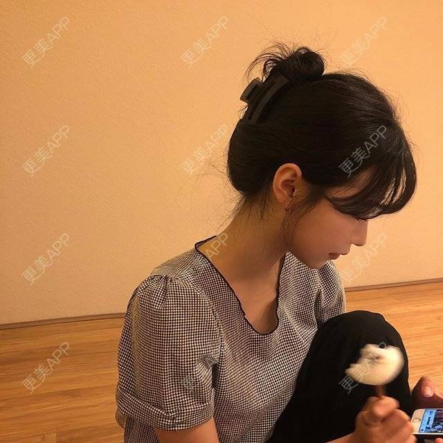更美 - 更美用户Ao4hWXHa7e的额头缩小经验 | 额头缩小