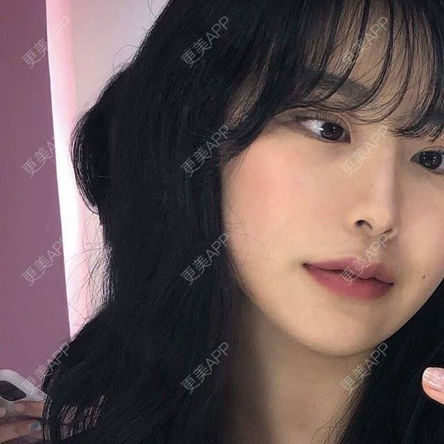 更美 - 更美用户Ao4hWXHa7e的额头缩小经验 | 额头缩小