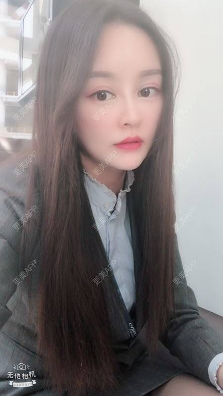 更美 - Face溜溜的自体脂肪隆胸经验 | 自体脂肪面部填充 | 自体脂肪隆胸 | 重庆