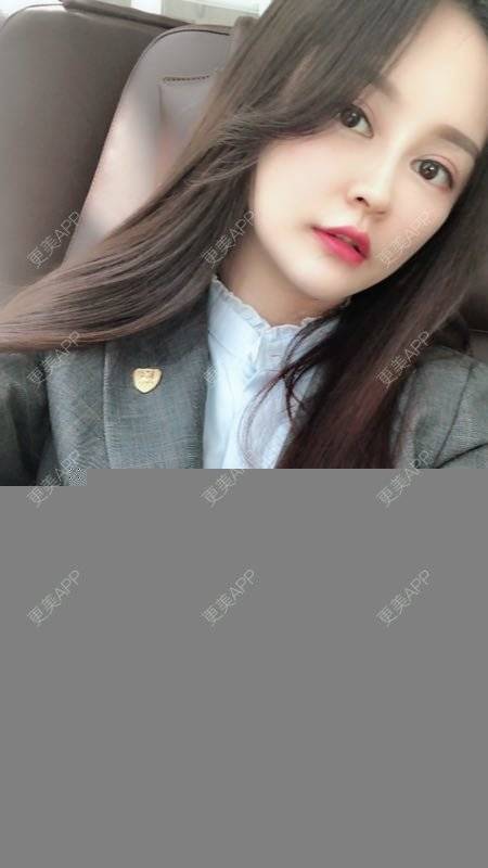 更美 - Face溜溜的自体脂肪隆胸经验 | 自体脂肪面部填充 | 自体脂肪隆胸 | 重庆